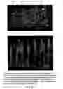 Fig. 22 - Isoforms of eIF-5A: senescence-induced eLF5A; wounding-induced eIF-4A; growth eIF-5A; and DHS