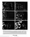 Fig. 30 - Isoforms of eIF-5A: senescence-induced eLF5A; wounding-induced eIF-4A; growth eIF-5A; and DHS