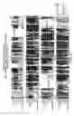 Fig. 50 - Isoforms of eIF-5A: senescence-induced eLF5A; wounding-induced eIF-4A; growth eIF-5A; and DHS