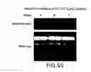 Fig. 58 - Isoforms of eIF-5A: senescence-induced eLF5A; wounding-induced eIF-4A; growth eIF-5A; and DHS