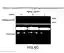 Fig. 63 - Isoforms of eIF-5A: senescence-induced eLF5A; wounding-induced eIF-4A; growth eIF-5A; and DHS