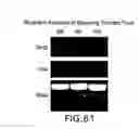 Fig. 64 - Isoforms of eIF-5A: senescence-induced eLF5A; wounding-induced eIF-4A; growth eIF-5A; and DHS