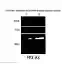Fig. 65 - Isoforms of eIF-5A: senescence-induced eLF5A; wounding-induced eIF-4A; growth eIF-5A; and DHS