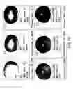 Fig. 79 - Isoforms of eIF-5A: senescence-induced eLF5A; wounding-induced eIF-4A; growth eIF-5A; and DHS