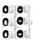 Fig. 80 - Isoforms of eIF-5A: senescence-induced eLF5A; wounding-induced eIF-4A; growth eIF-5A; and DHS