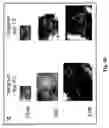 Fig. 08 - Methods for increasing the frequency of apomixis expression in angiosperms