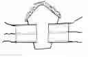 Fig. 01 - Bambino bundle