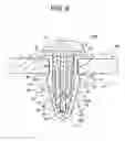 Fig. 10 - Clip