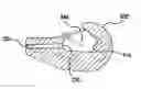 Fig. 01 - Tank retaining system