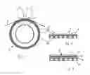 Fig. 02 - Method for embossed and colourless decoration and bonding of a fabric web and device therefor