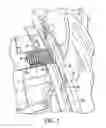 Fig. 04 - Bevel and depth of cut detent system