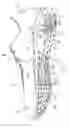 Fig. 02 - Track shoe with heel plate and support columns