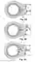 Fig. 10 - Reversible ratcheting tool with improved control member