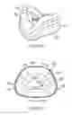 Fig. 35 - Respiratory mask assembly with magnetic coupling to headgear assembly