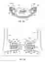 Fig. 51 - Respiratory mask assembly with magnetic coupling to headgear assembly