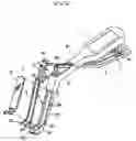 Fig. 02 - Surgical method for mandibular angle fracture operation and devices therefor