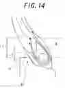 Fig. 10 - Pneumatic tires with carcass cord turnup bending portion