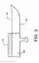 Fig. 05 - Method of affixing a pre-formed gasket and gasket used therefor