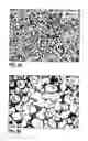 Fig. 08 - Process for injection molding semi-solid alloys