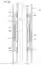 Fig. 07 - Bi-directionally boosting and internal pressure trapping packing element system