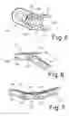 Fig. 03 - Conveyor chain