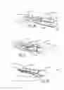 Fig. 13 - GRAPHIC VIEWABLE THROUGH ENCASEMENT OF VACUUM-PACKED DIAPER