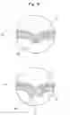 Fig. 10 - Discharge container having a squeezable and deformable