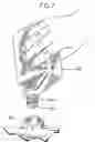 Fig. 07 - Pressure activated self opening container and seal
