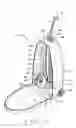Fig. 04 - Towable wheeled-backpack