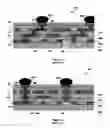 Fig. 02 - Structure of stacked vias in multiple layer electrode device carriers