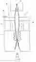 Fig. 01 - Moulding method, in particular a blowing or vacuum moulding method for production of a dispensing container filled with a medium for dispensing