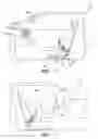 Fig. 02 - Static driver airbag module using steering wheel mounted gears