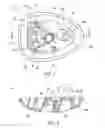Fig. 06 - Modular mounting assembly