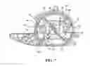 Fig. 07 - Integrated brush-holder retention system