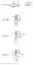 Fig. 06 - Discharge lamp, method for producing the same and lamp unit