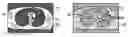 Fig. 01 - Method and magnetic resonance tomography apparatus for producing phase-coded flow images