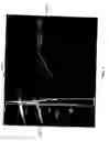 Fig. 05 - Multicoil image analysis for magnetic resonance image segmentation, registration, and reconstruction