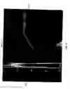 Fig. 06 - Multicoil image analysis for magnetic resonance image segmentation, registration, and reconstruction