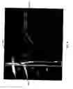 Fig. 09 - Multicoil image analysis for magnetic resonance image segmentation, registration, and reconstruction