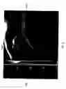 Fig. 10 - Multicoil image analysis for magnetic resonance image segmentation, registration, and reconstruction