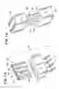 Fig. 08 - Electromagnetically shielded slot transmission line