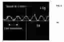 Fig. 08 - Motion detection using a shock sensor in a remote tire pressure monitoring system