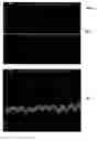 Fig. 09 - Motion detection using a shock sensor in a remote tire pressure monitoring system