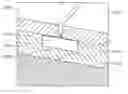 Fig. 01 - Printhead tile for use in a printing system