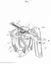 Fig. 02 - Device at a mixing container for preparation of bone cement