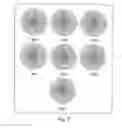 Fig. 08 - Sound collector
