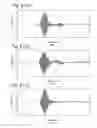 Fig. 22 - Sound collector