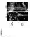 Fig. 04 - Method of reducing angiogenesis