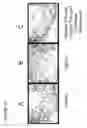 Fig. 16 - Method of reducing angiogenesis