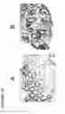 Fig. 17 - Method of reducing angiogenesis